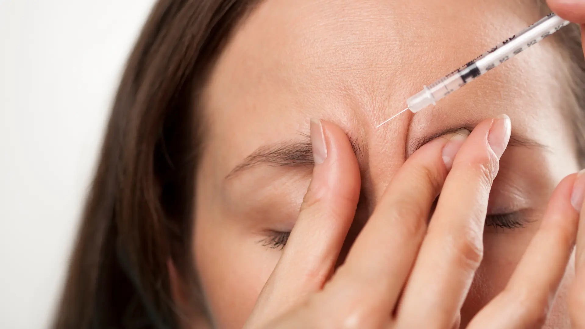 Botox Nabota (1 Zone)